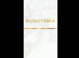 Bichectomía - Dra. Katherin Ruiz Márquez