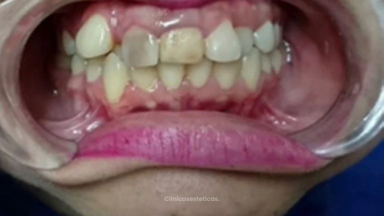 Ortodoncia - Dra. Katherin Ruiz Márquez