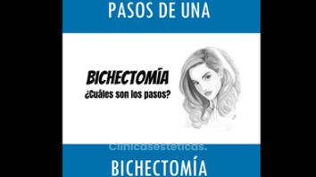 Bichectomía - Doctor Horacio Valdivia Meza