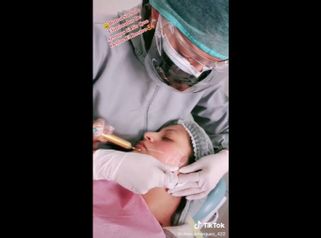 Bótox - Dra. Katherin Ruiz Márquez