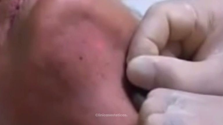 Muestra un cuello más joven