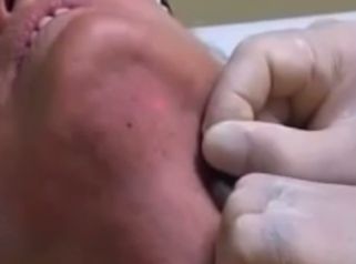 Muestra un cuello más joven