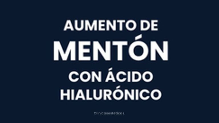 Aumento de mentón - IDENTAL