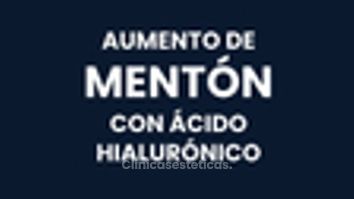 Aumento de mentón - IDENTAL