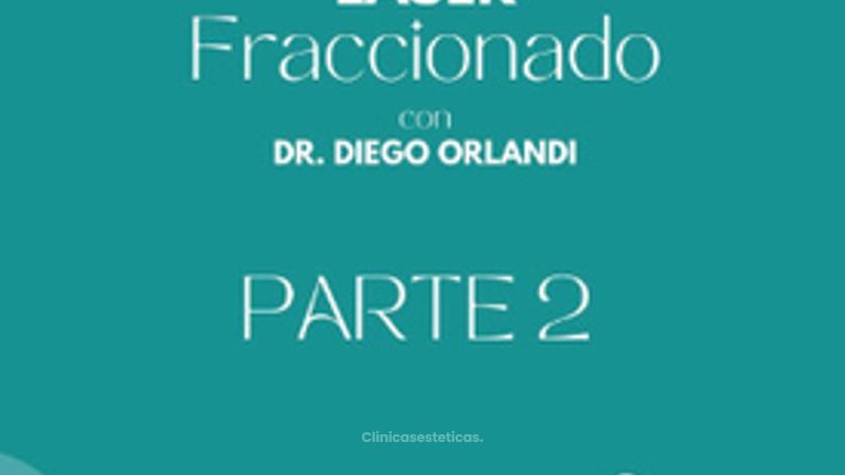 Lasér CO2 Fraccionado para Tratamientos Acne