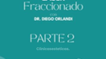 Lasér CO2 Fraccionado para Tratamientos Acne