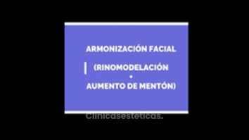 Armonización facial - Dr. Gunther Rochefort
