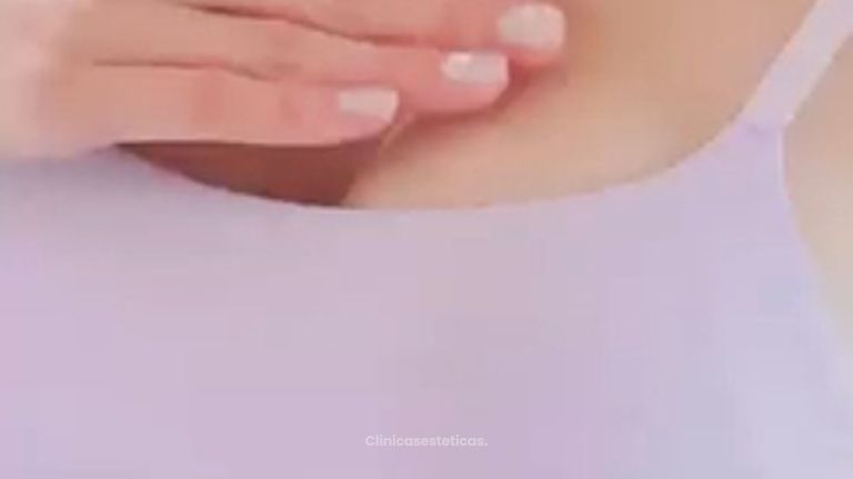 Cuidado de las incisiones Aumento Mamario - Dr. René Flores Aqueveque