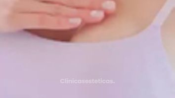 Cuidado de las incisiones Aumento Mamario - Dr. René Flores Aqueveque