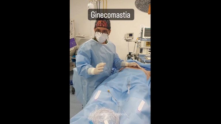 Ginecomastia - Cirugía Plástica Dieppa
