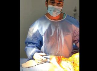 Abdominoplastia - Dr. Brian Frick 
