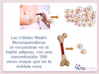 Rejuvenece con tus propias células madre