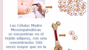 Rejuvenece con tus propias células madre