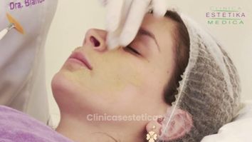 Consigue un aspecto facial más fresco