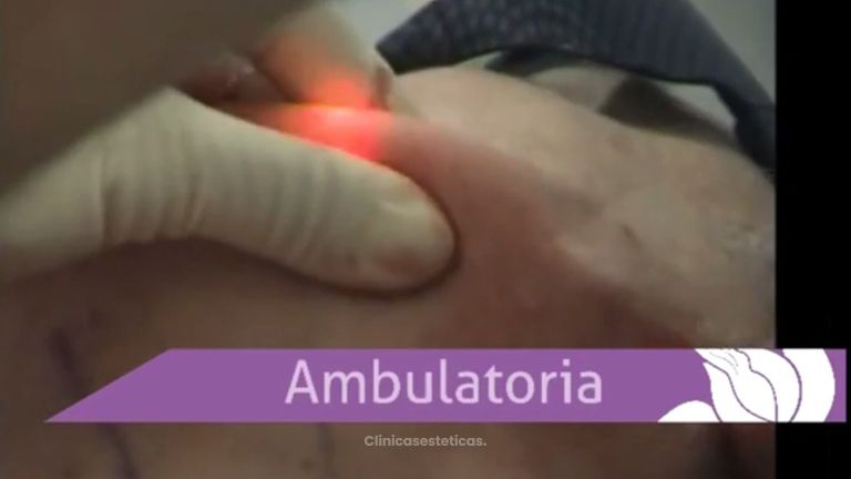 Mejora el aspecto de tu rostro