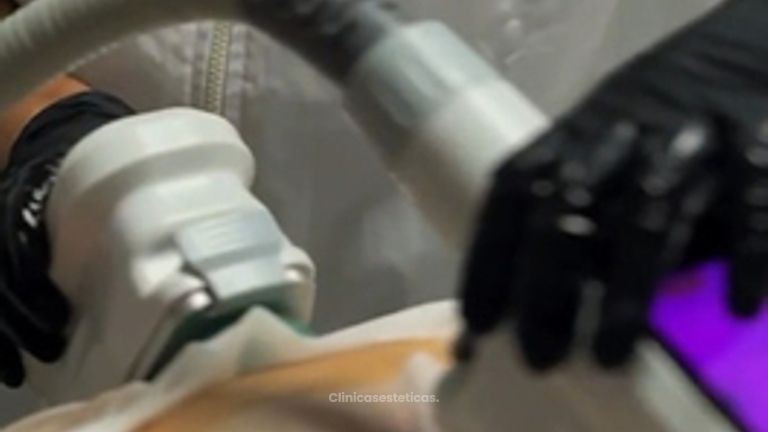 Criopolisis - Amarna