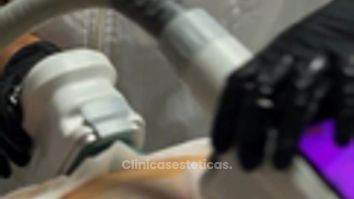 Criopolisis - Amarna