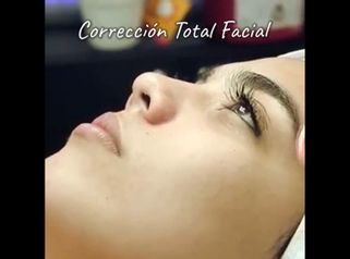 Rejuvenecimiento facial - Clínica Berríos