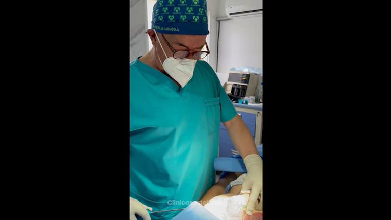 Liposucción - Dr Nicolas Adriazola