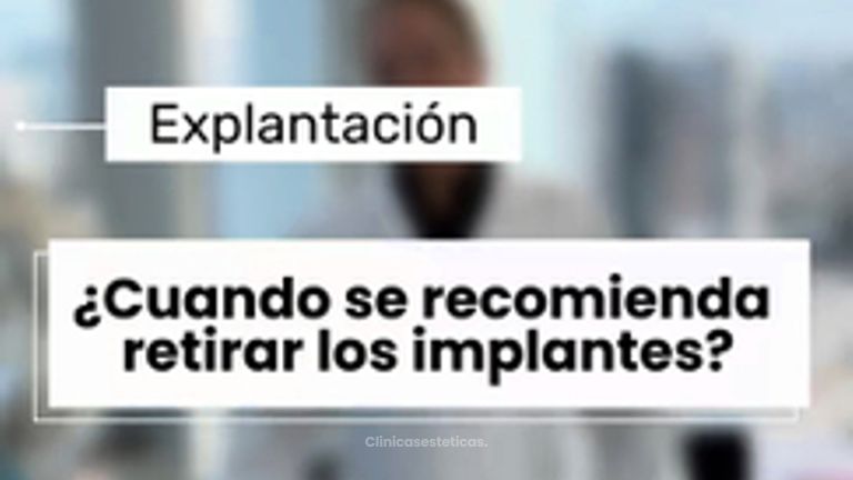 Cuando se recomienda retirar los implantes? - Dr. Vicente Sánchez Liberona