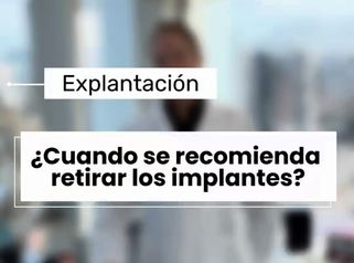Cuando se recomienda retirar los implantes? - Dr. Vicente Sánchez Liberona