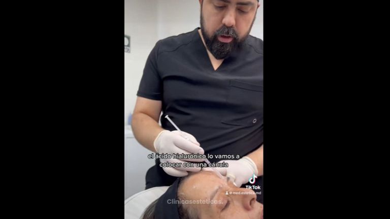 Ácido Hialurónico - Medicina Estética Integral MD