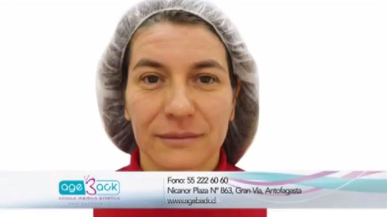 Consigue un rostro más joven y bonito