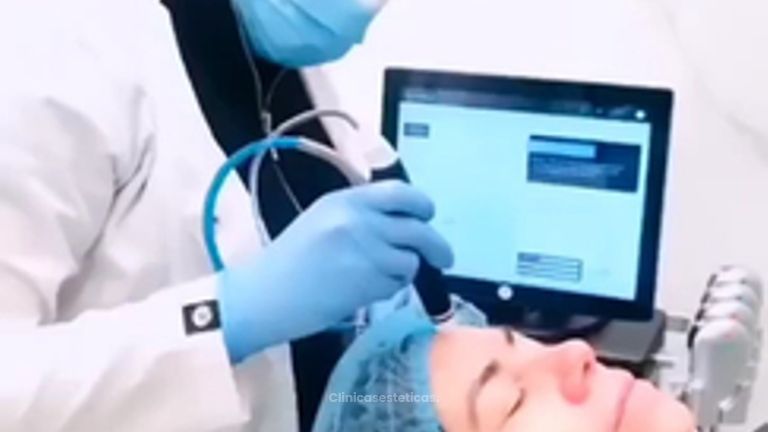 Hydrafacial - Clínica Pichimapu