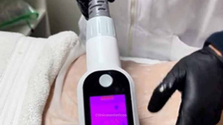 Criopolisis - Amarna