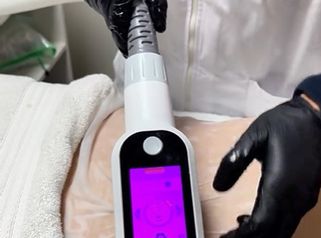 Criopolisis - Amarna