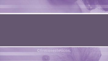 Ginecomastia - Doctor Patricio Stevens Moya