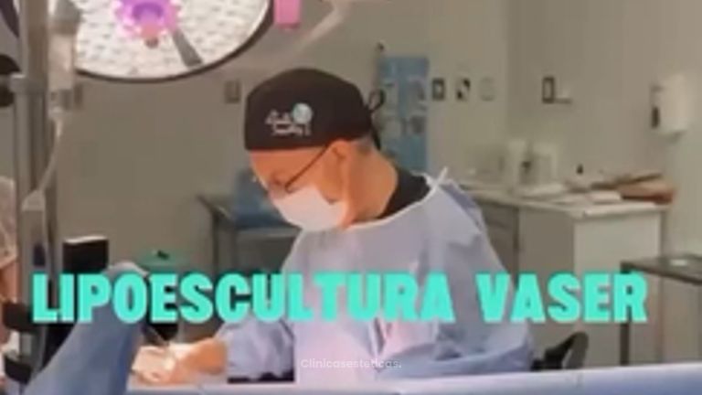 Lipoescultura Vaser - Dr. Vicente Sánchez Liberona