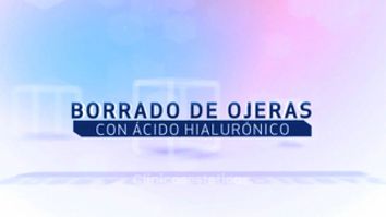 Borrado de ojeras con Ácido Hialurónico - Vitaclinic