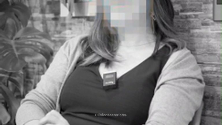 Testimonio - Implantes dentales - Paulina López