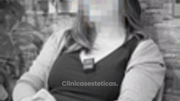 Testimonio - Implantes dentales - Paulina López