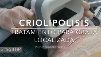 Criolipólisis