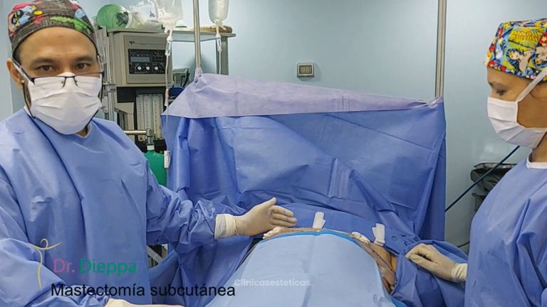 Mastectomía subcutánea - Cirugía Plástica Dieppa