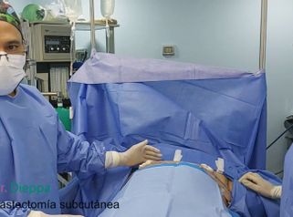 Mastectomía subcutánea - Cirugía Plástica Dieppa