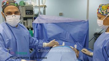 Mastectomía subcutánea - Cirugía Plástica Dieppa