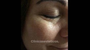 Testimonio Micropigmentación Eyeline y Cejas