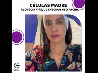 Células madre - Clínica Dra. Kelly Gulfo