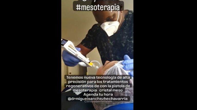 Mesoterapia - Dr. Miguel Enrique Sánchez Hechavarria