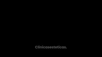 PREGUNTAS EXPLANTE DR VICENTE PARTE 2