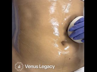 Venus Legacy - Amanda Beauty