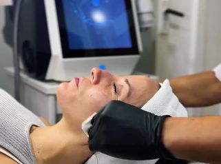 ✨ Llegó la combinación perfecta en Amarna - Rejuvenecimiento Facial - Amarna