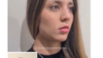 Armonización facial.