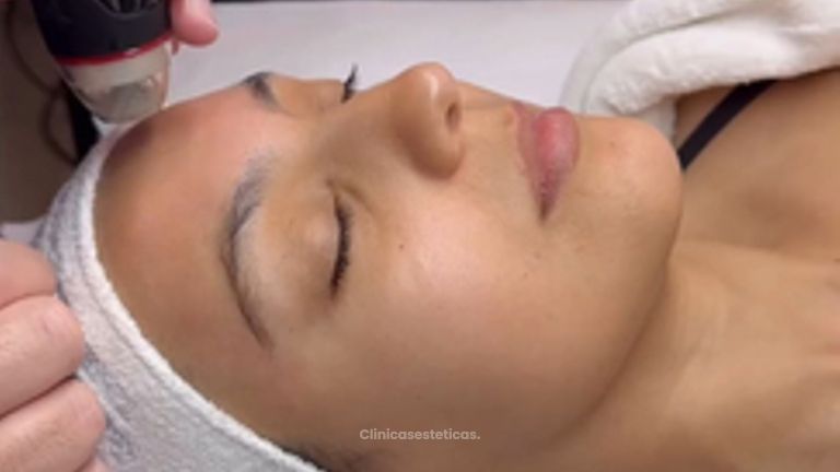 Limpieza Facial Profunda DermaClear - Novavita Ltda