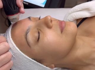 Limpieza Facial Profunda DermaClear - Novavita Ltda