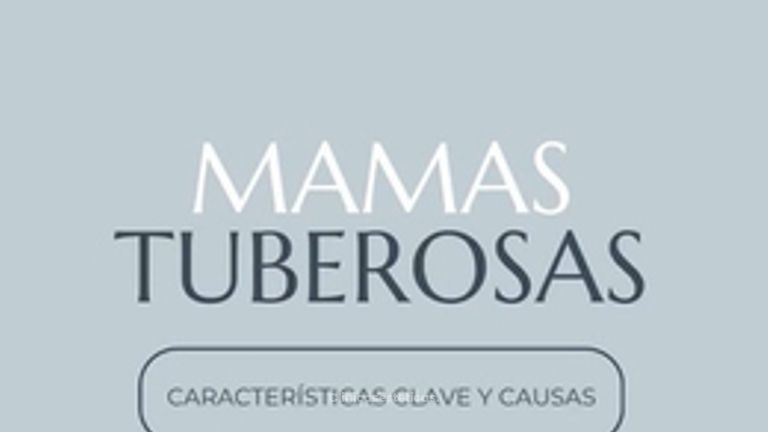 Mamas tuberosas - Dr. Nadir Carda