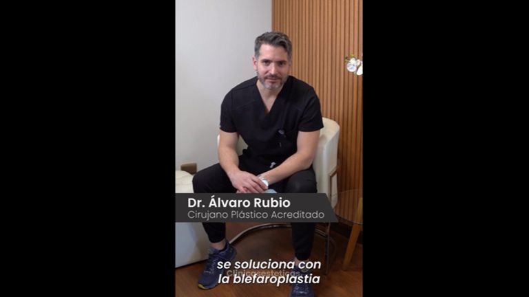 Blefaroplastia - Dr. Alvaro Rubio González